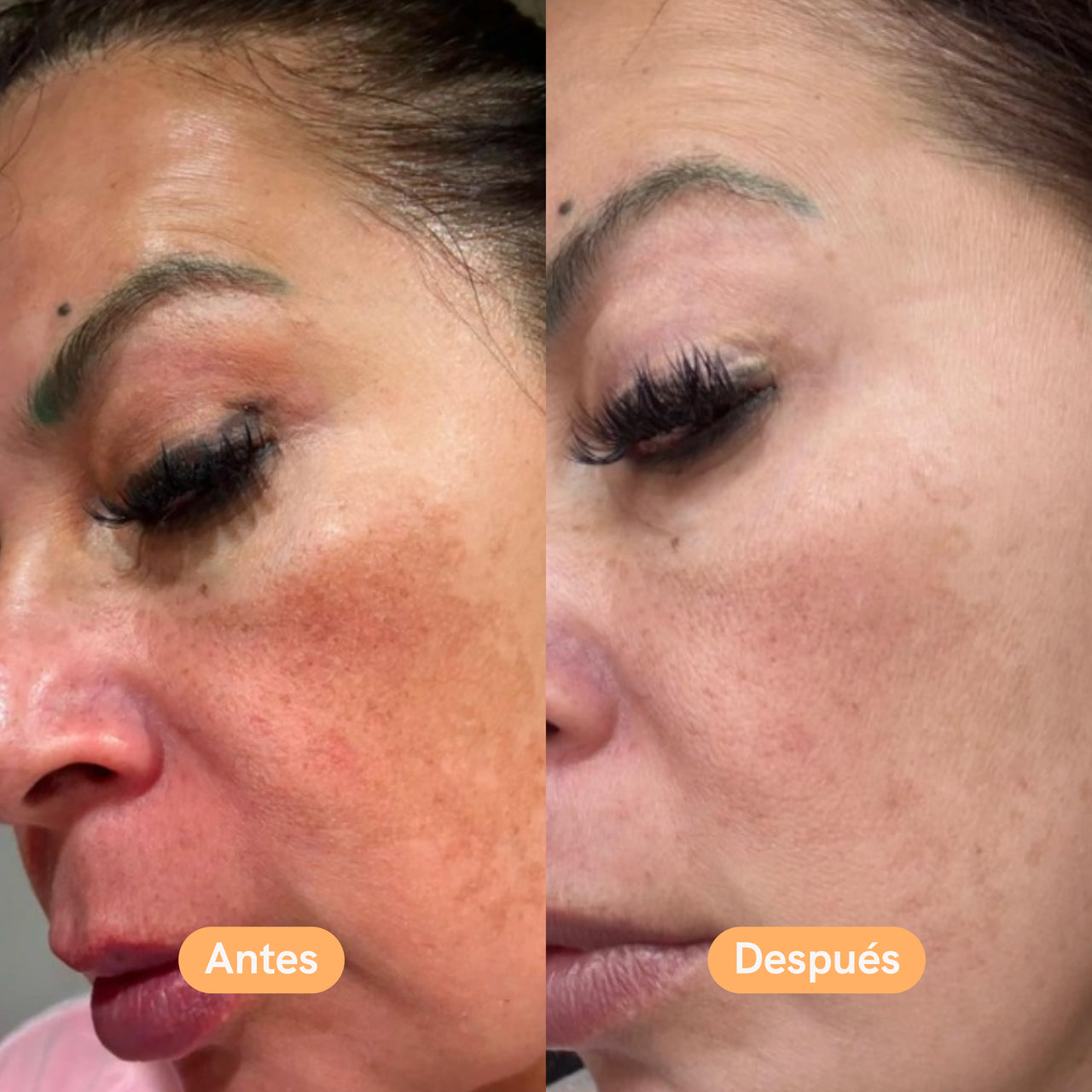 LummiMask